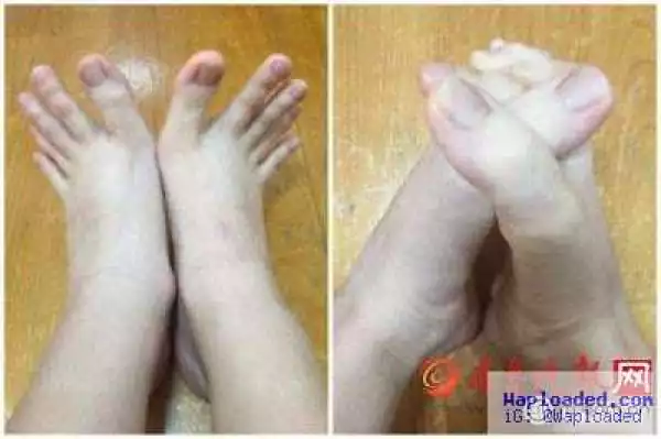 Photos: See girl whose toes are as long as fingers, that she even uses them to write